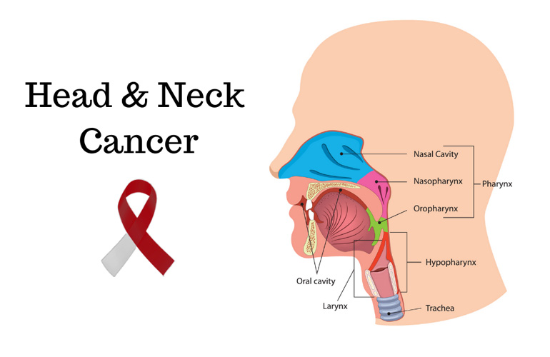 Head and Neck Cancer Specialist in Faridabad 